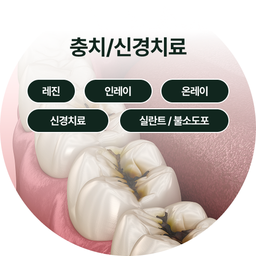턱관절 치료